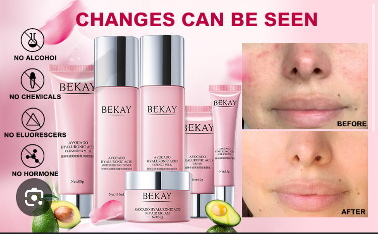 BELAY AVOCADO HYALURONIC ACID 6 PIECE SET
